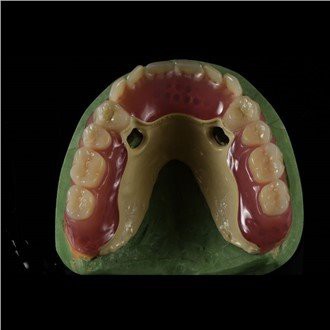 Zobna proteza Peek Framework