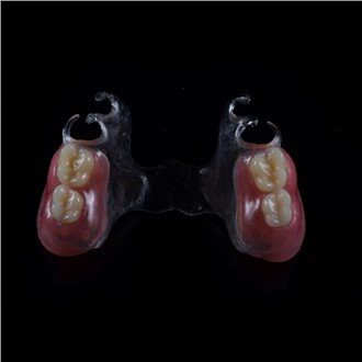 Odstranljiva akrilna delna proteza