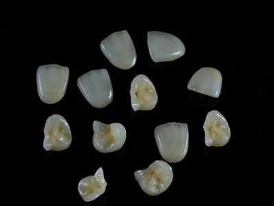 Kako izbrati najboljše zobno lepilo za krone: najnovejši vodnik