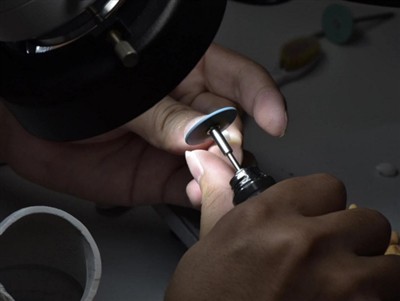 Kako dolgo trajajo krone PFM? Povprečna življenjska doba, dejavniki in nasvet...