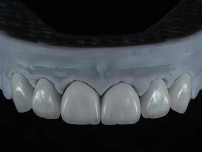 Kako zunanjemu izvajalcu zobotehničnega laboratorija omogočiti delo v tujini:...